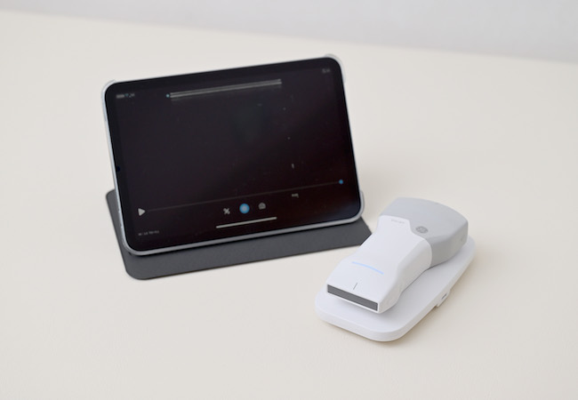 超音波画像診断装置